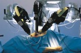 Al Gemelli con il robot Da Vinci si opera la tiroide di una paziente senza lasciare segni sul collo