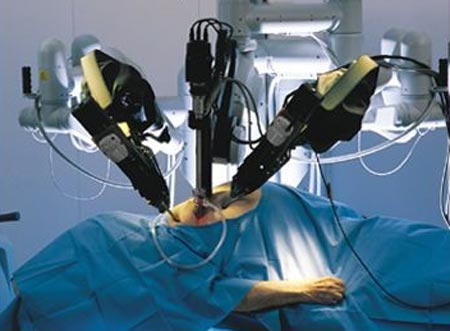 Al Gemelli con il robot Da Vinci si opera la tiroide di una paziente senza lasciare segni sul collo